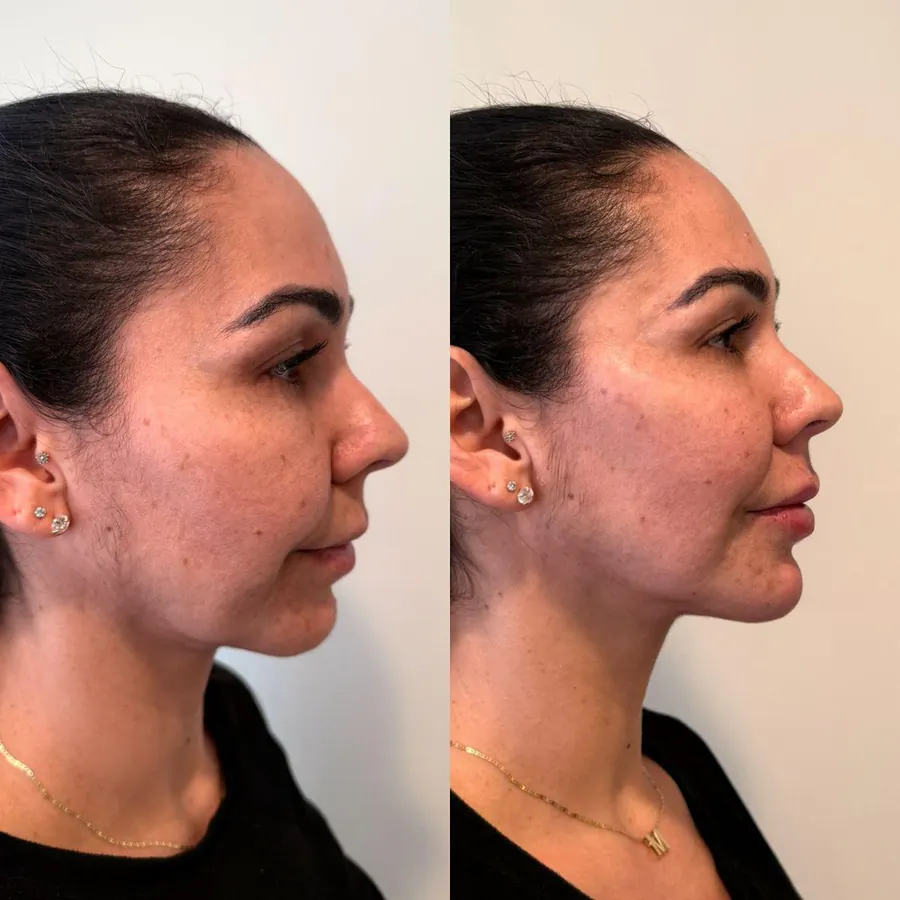 Definição Mandibular